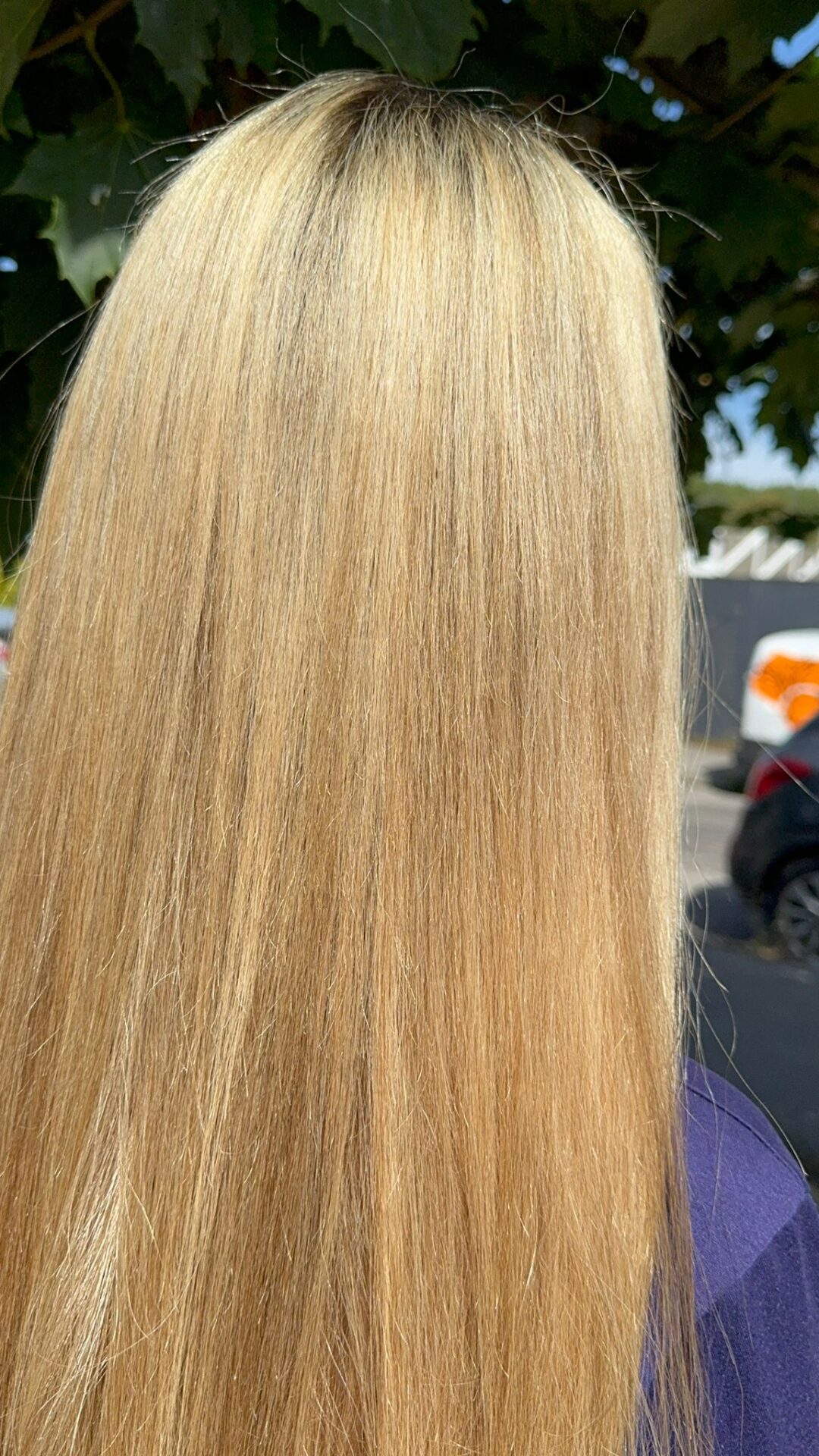 after smoothing treatment results taunton